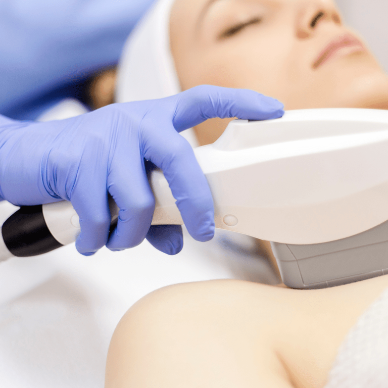 FOTOEPILACIJA sarajevo fotodepilacija sarajevo lasersko uklanjanje dlacica sarajevo