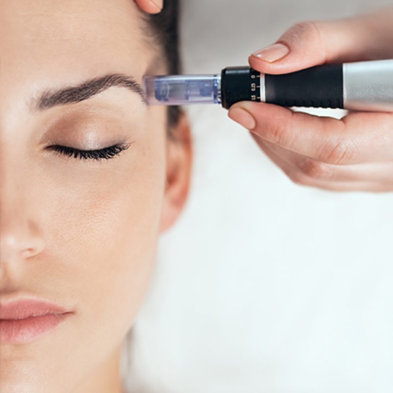 dermapen sarajevo fotodepilacija